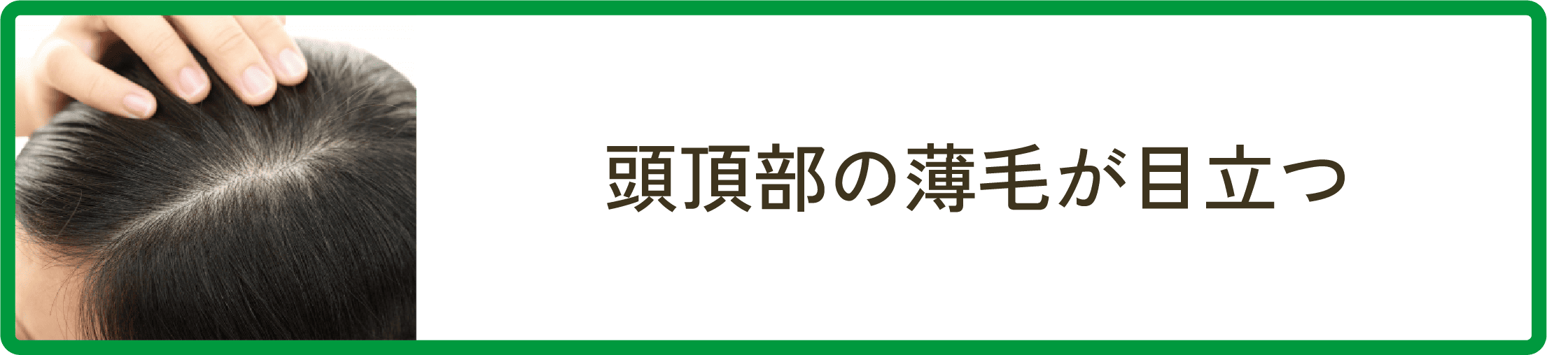 頭頂部の薄毛が目立つ