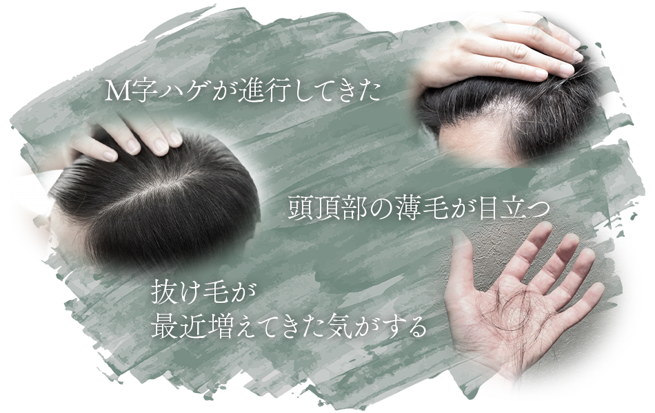 薄毛の悩みはスーパースカルプへ